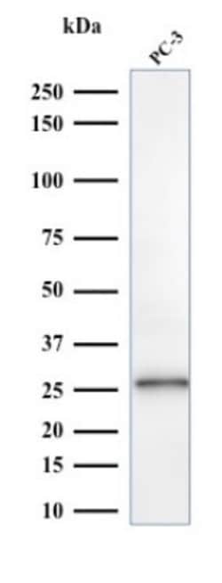Complement Component C1qA, Mouse anti-Human, Clone: C1QA/2953, Novus Biologicals